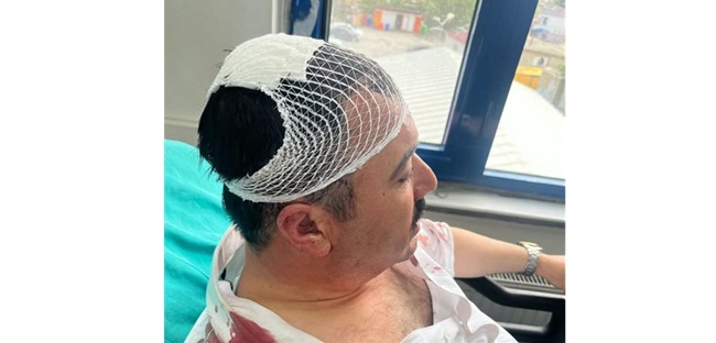 Kahramanmaraş’ta Belediye Başkan Yardımcısına Saldırı Kahramanmaraş’ın Dulkadiroğlu ilçesinde Belediye Başkan